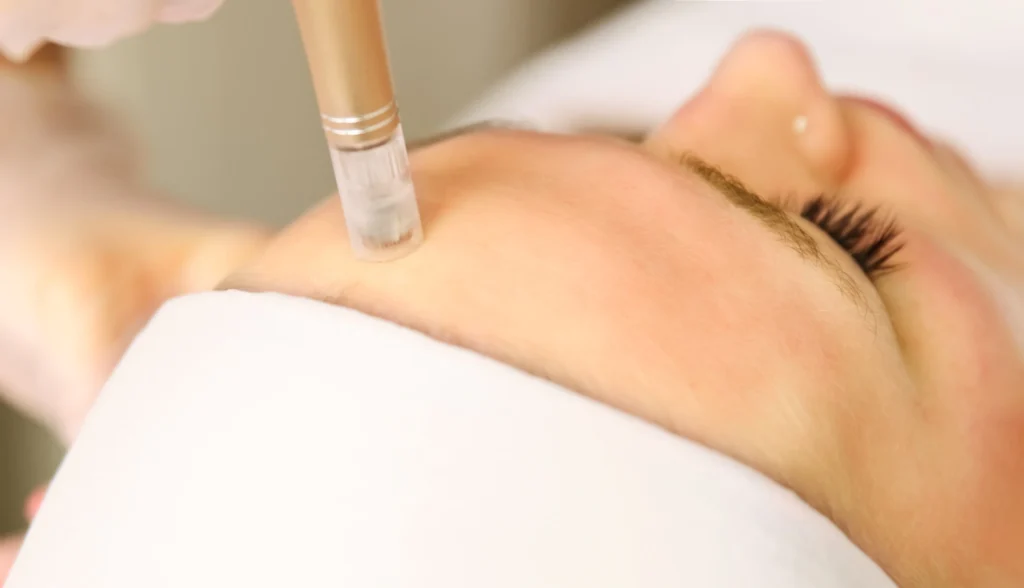 AquaGold Facial in Lake Forest, IL