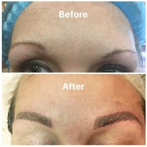 Microblading Before and After