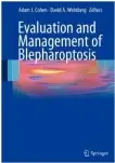 evaluation and management of blepharoptosis