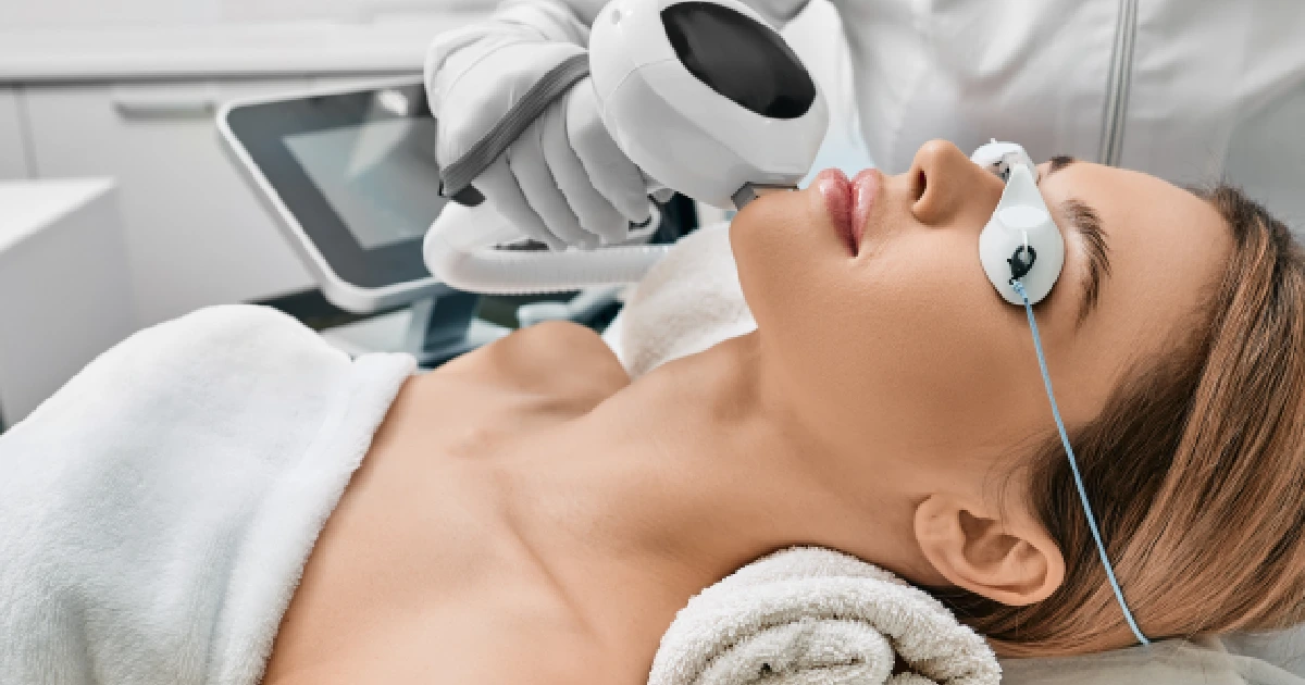 Patient receiving vascular laser therapy in Lake Forest, IL, to treat facial rosacea