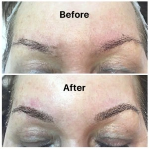 Microblading Women Forehead Before and After