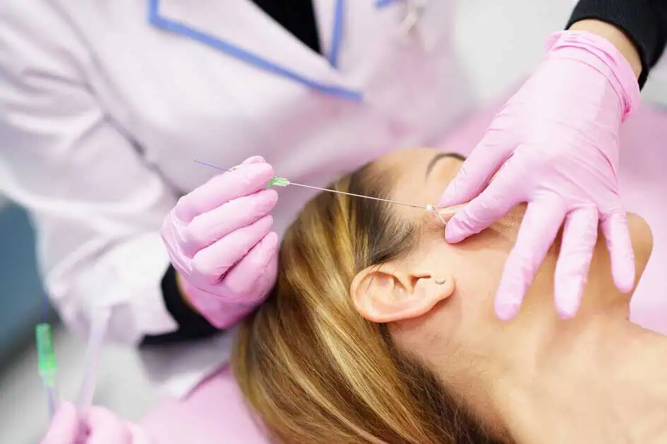 PDO Thread Lift in Lake Forest IL by The Aesthetic Lounge